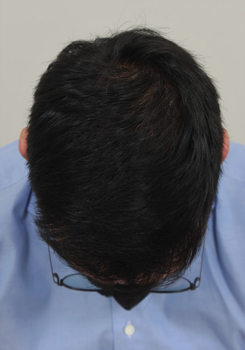 2.수술후.JPG