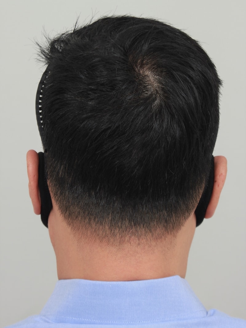 4.수술후.JPG