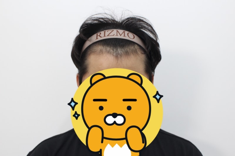 1년전_정면.jpeg