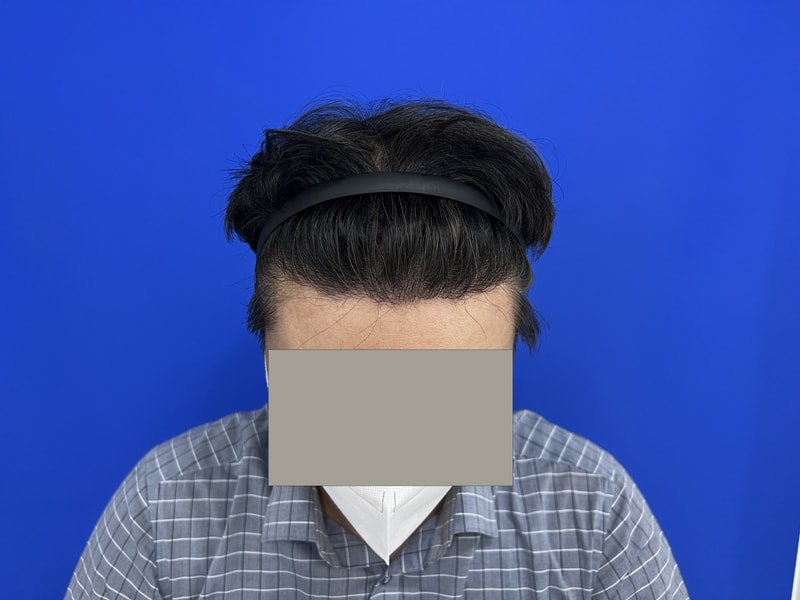 후 3.jpg