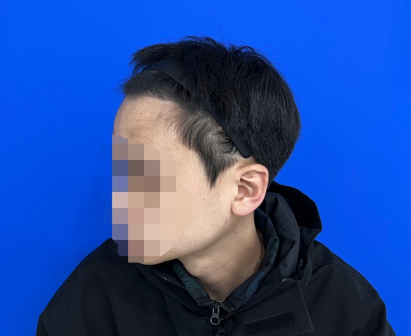 후 2.jpg