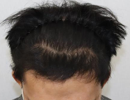 칠.png