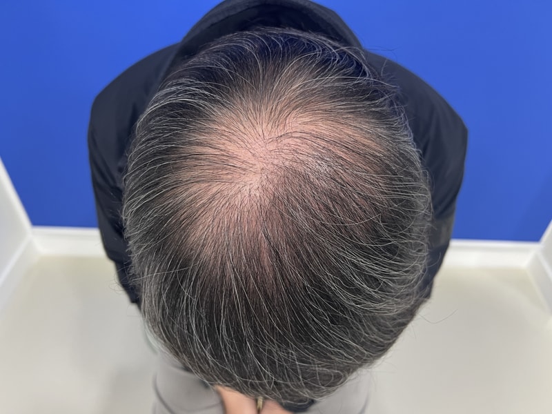 치료전 1.JPG