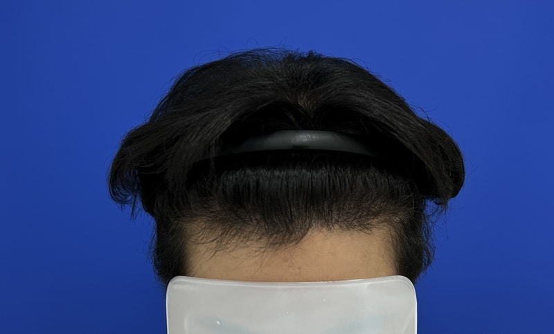 수술후 1.jpg