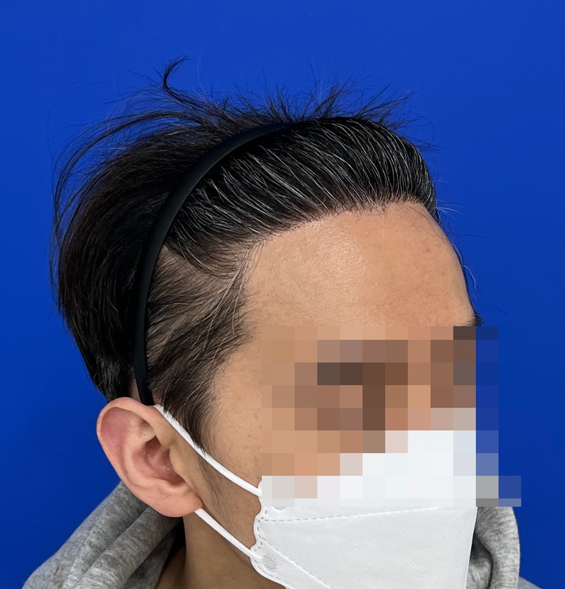 수술후 3.jpg