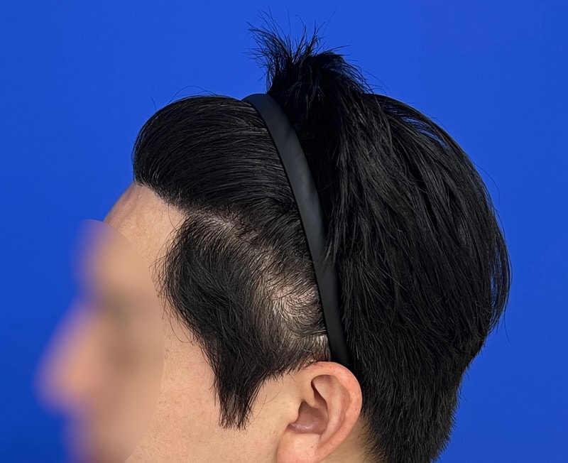 수술후 3.jpg