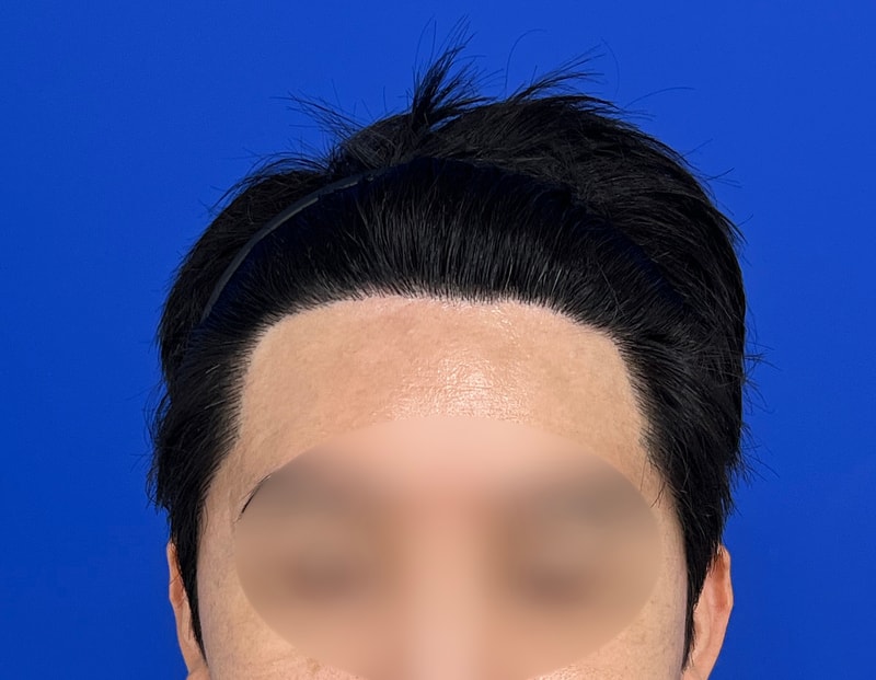 수술후 2.jpg