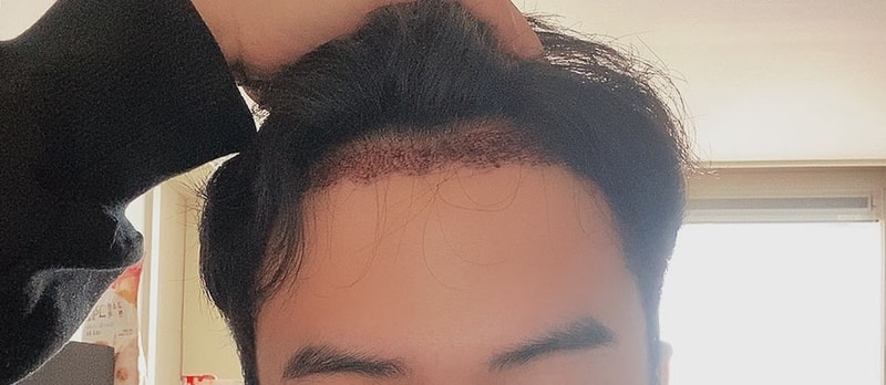 후.jpg