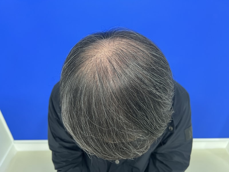 치료전 2.JPG