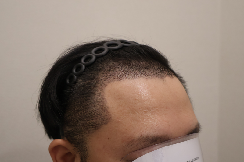수술후2.png