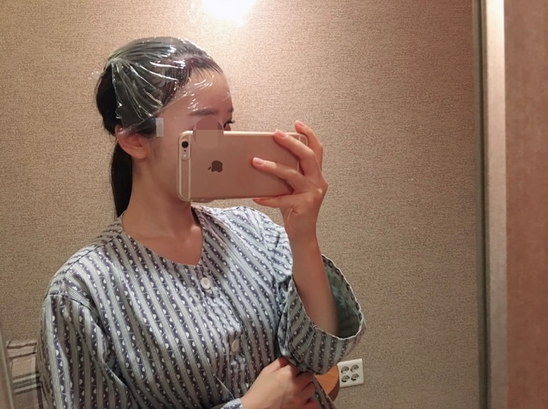 해어라인교정 1년 경과 후기입니다 :)