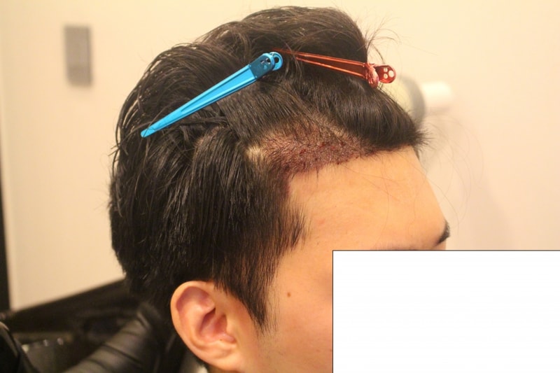 1.JPG