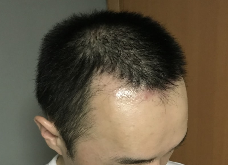 48일(2).jpeg