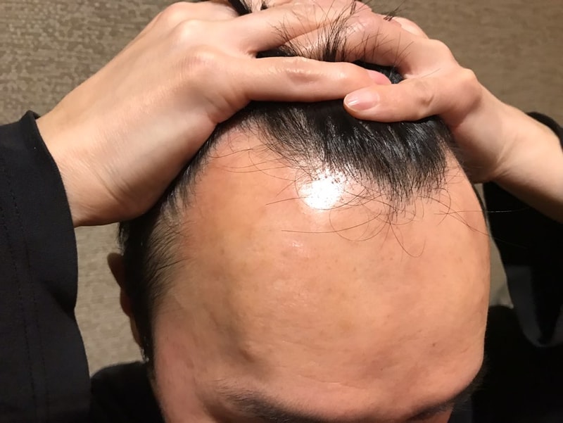 4달경과 사진입니다.