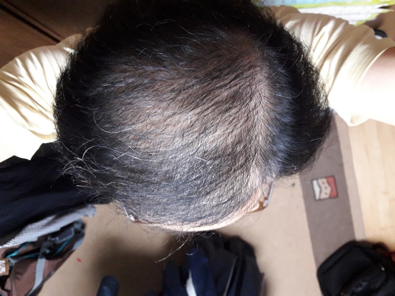 20190421 120일.jpg