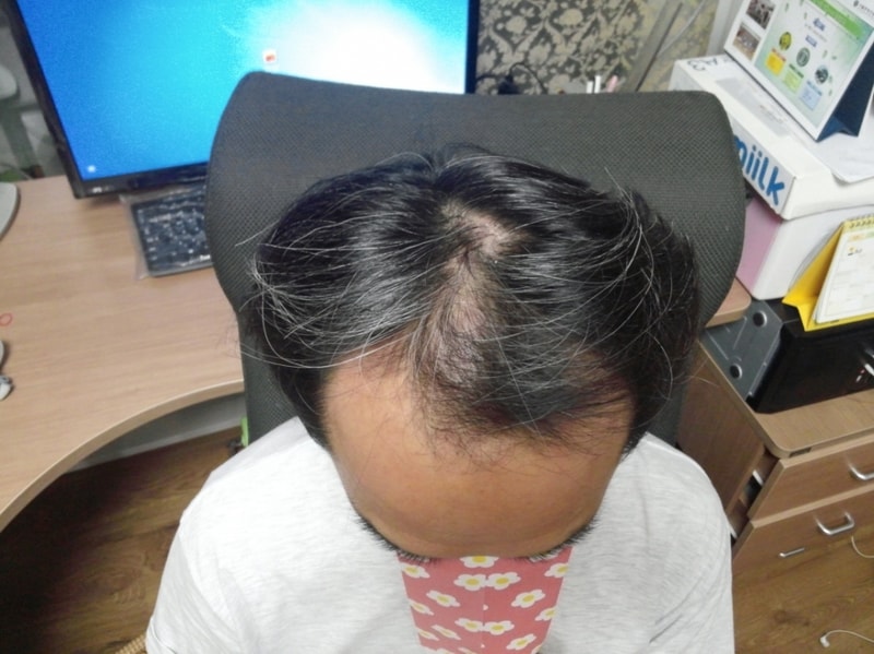 꾸미기_수술전_1.jpg