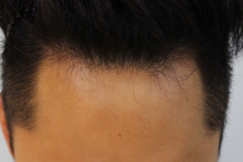 수술전 (1).JPG