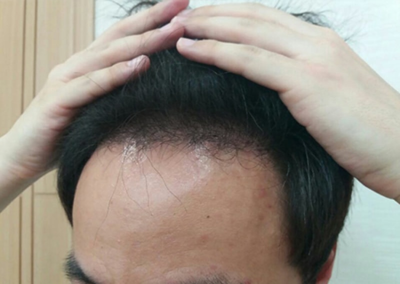 5개월3.jpg