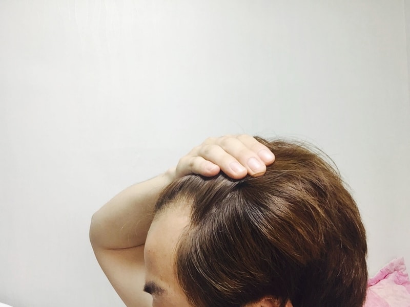 다나성형외과 후기입니다 한을 풀었네요
