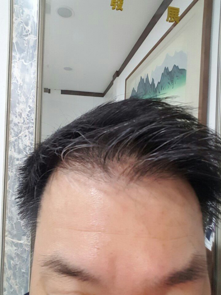 조영민수술전.jpg