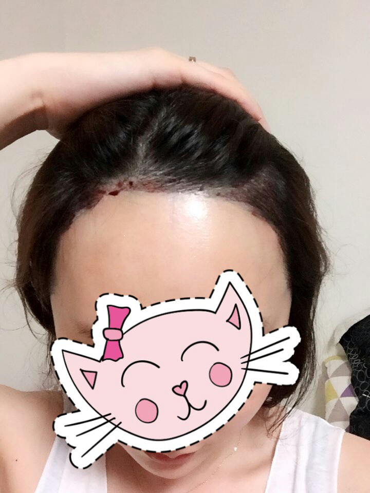 KakaoTalk_20170920_172616234.jpg