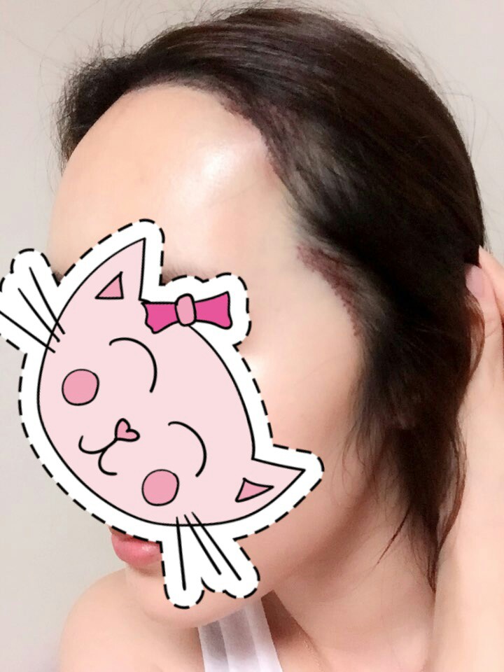 KakaoTalk_20170920_172615947.jpg