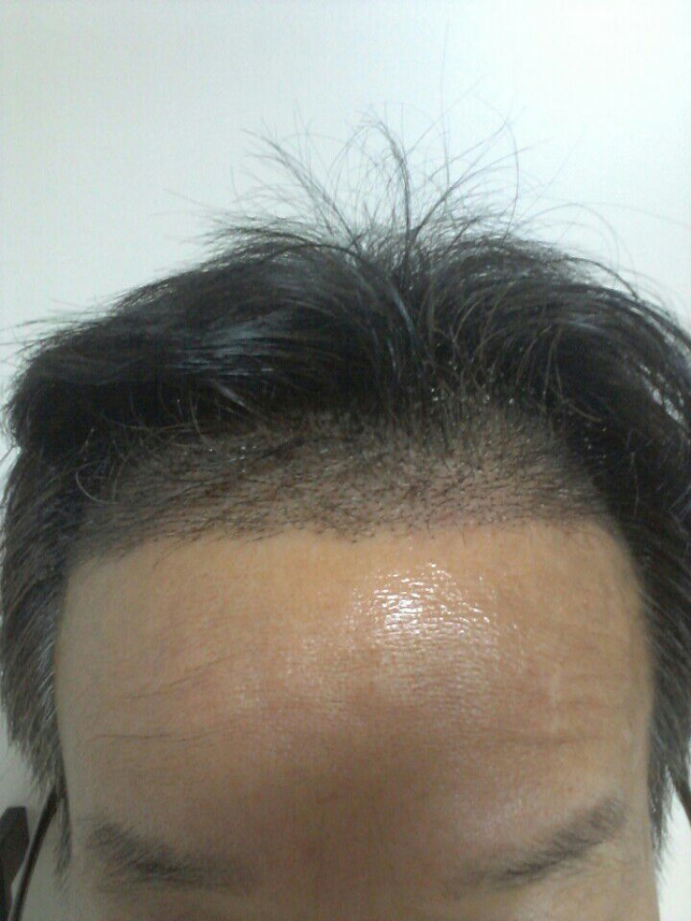 수술후2.jpg