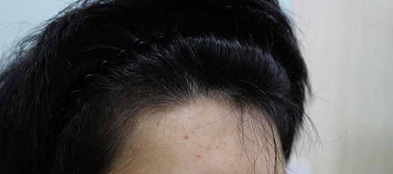 수술전 (5).JPG