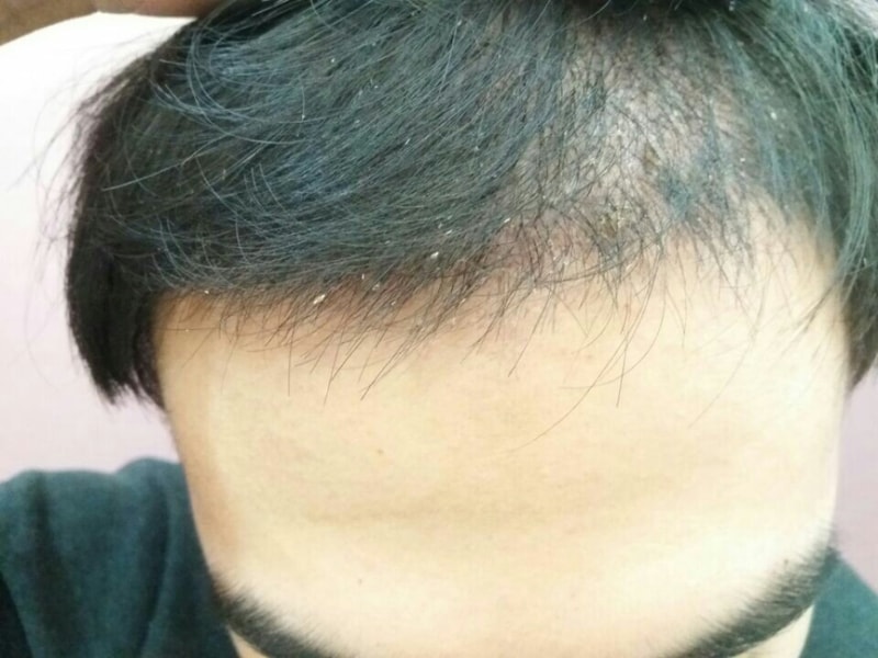 후3.jpg