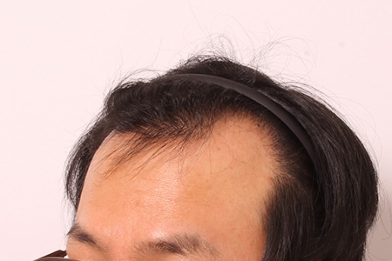전1.jpg