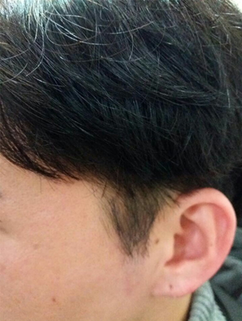 후구렛나루2.jpg