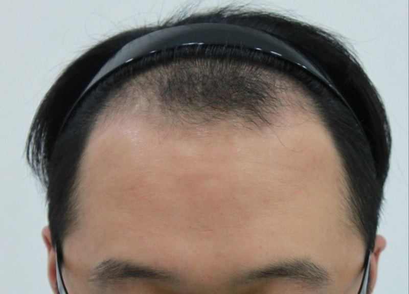 수술전..jpg