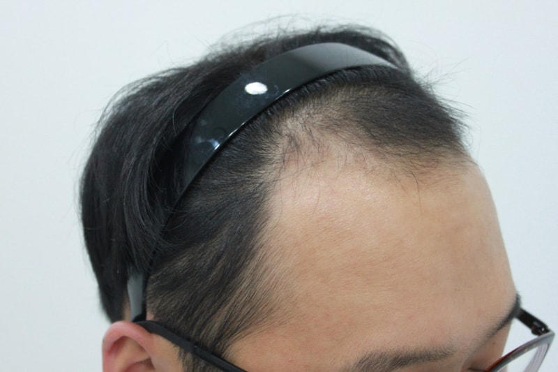 수술전...JPG
