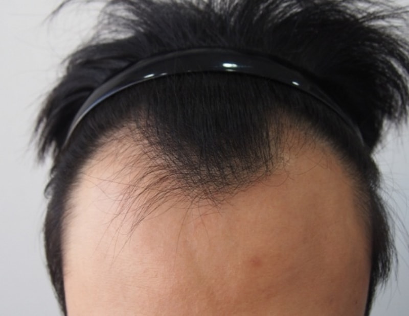 수술전.jpg