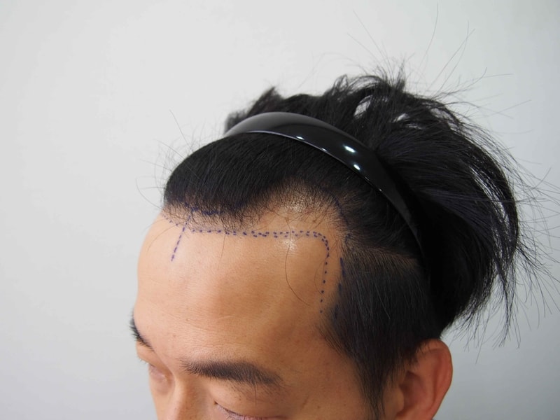 크기변환_수술전2.JPG