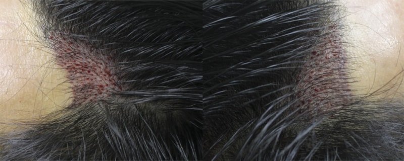 김 도연_20160607_모발_27774.png