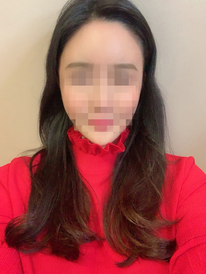 수술한달03.jpg