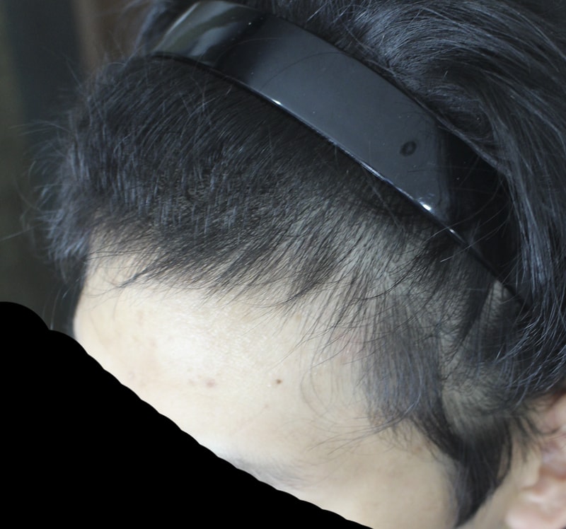 003.jpg