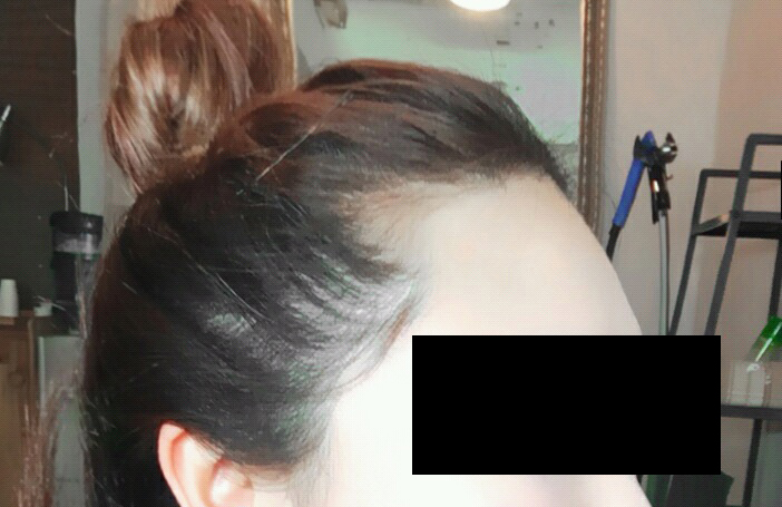 수술전.jpg
