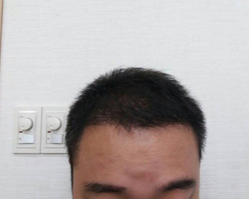 후1.jpg