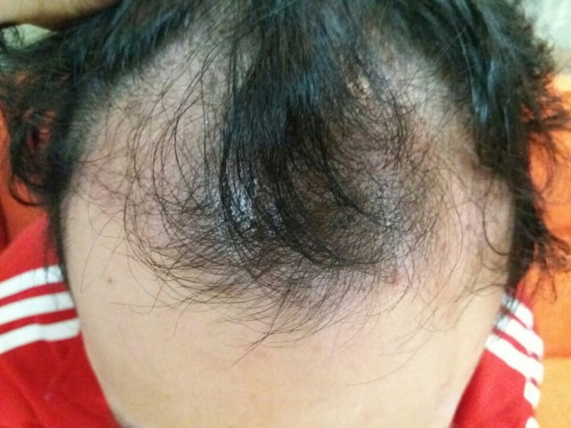 KakaoTalk_Moim_5SdY6oNQM3Yym1iqnPCUNoRMn4hI66.jpg