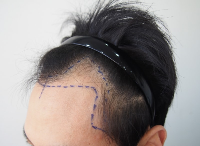 크기변환_06수술디자인.jpg