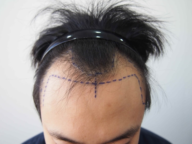 크기변환_04 수술디자인.JPG