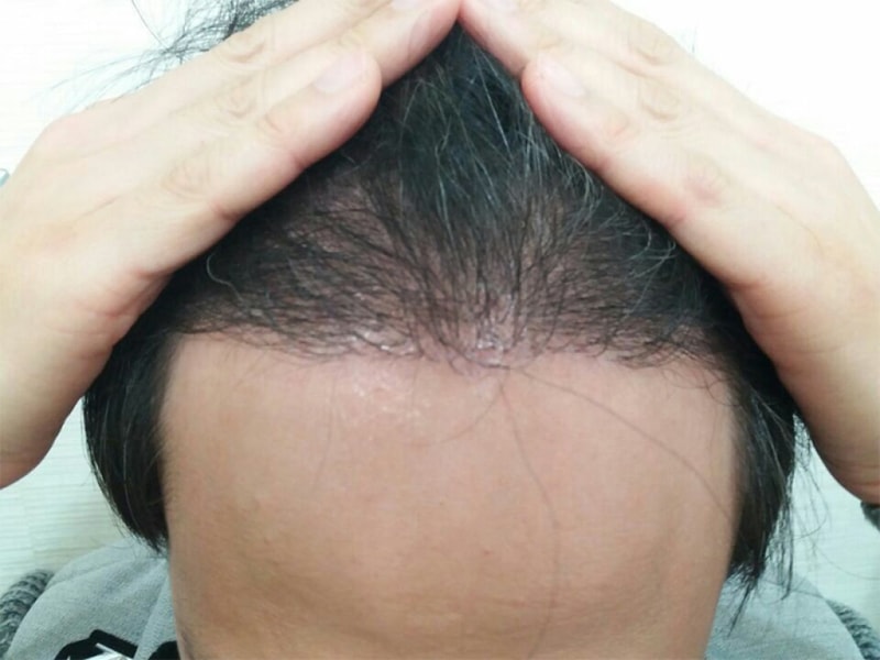 후2.jpg