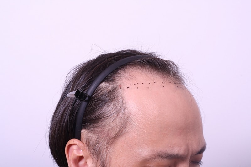 전1.jpg
