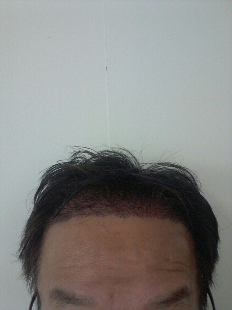 수술후3.jpg
