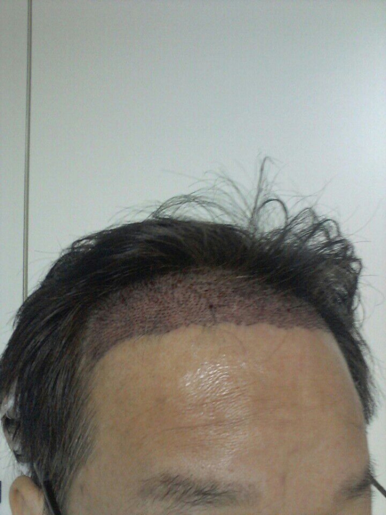 수술후2.jpg
