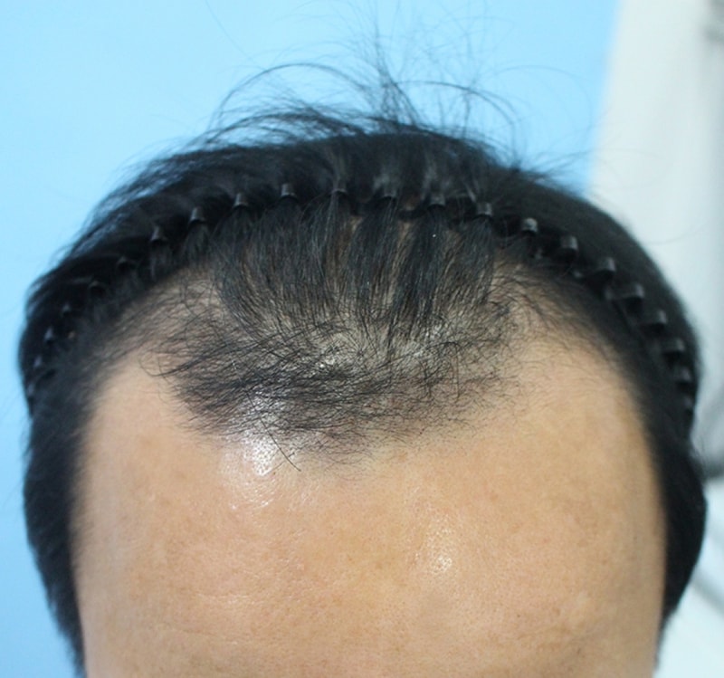 김 주화_20160225_모발_12467.jpg