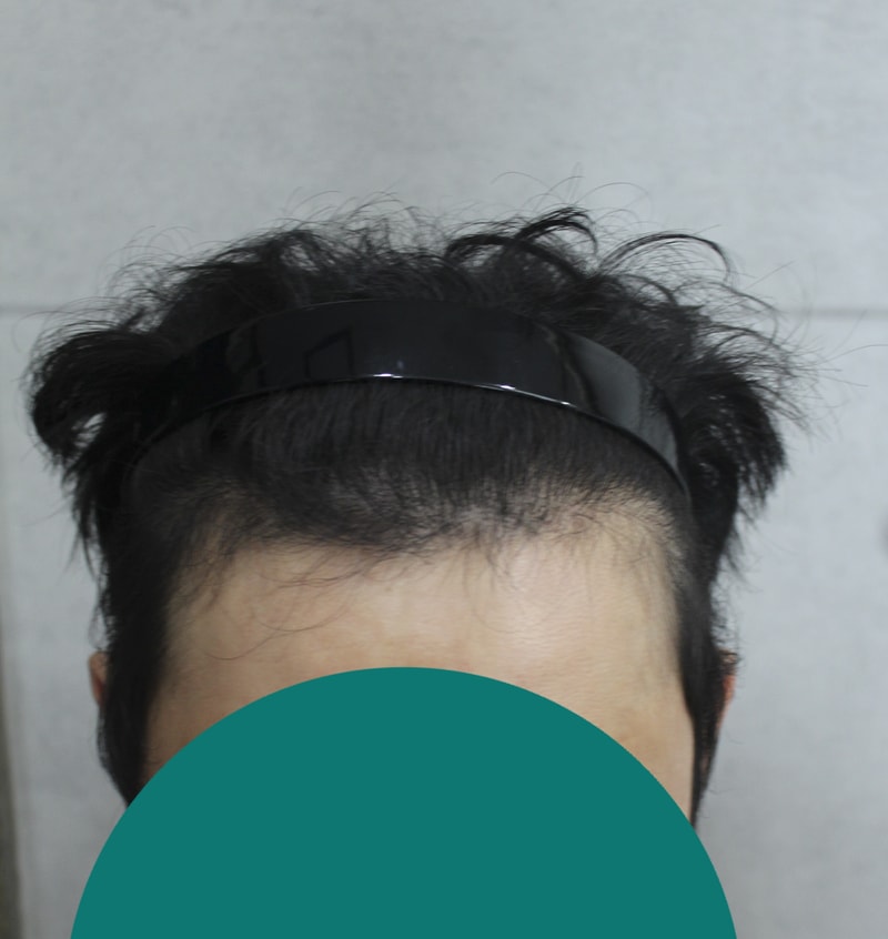 003.jpg