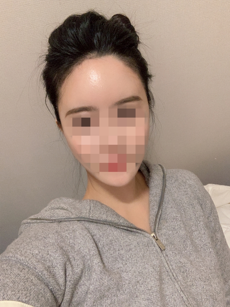 수술일주일01.jpg